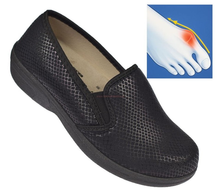 półbuty damskie na haluksy czarne BIOUP P-429 imitacja skóry wężowej