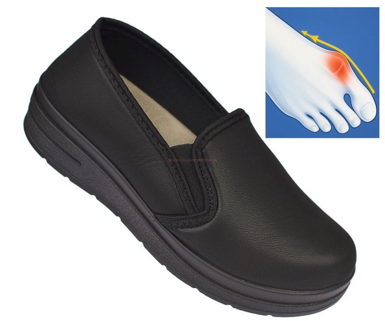 półbuty damskie na haluksy czarne BIOUP P-729 skóra syntetyczna