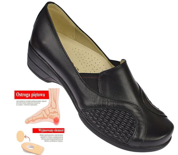 buty na ostrogi piętowe osteofity